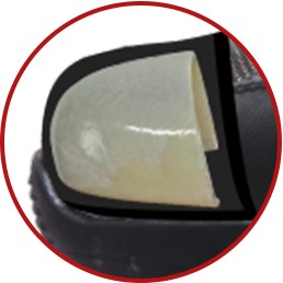 Anti Smash Toe